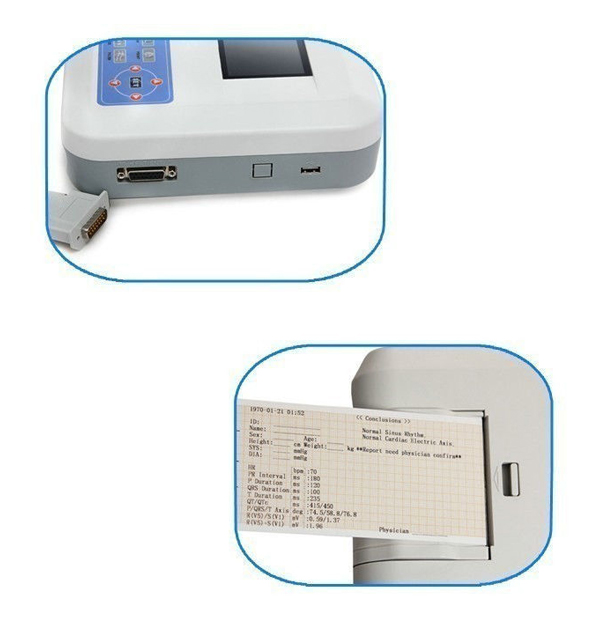 ecg-with-3-leads-interpretation-image-3