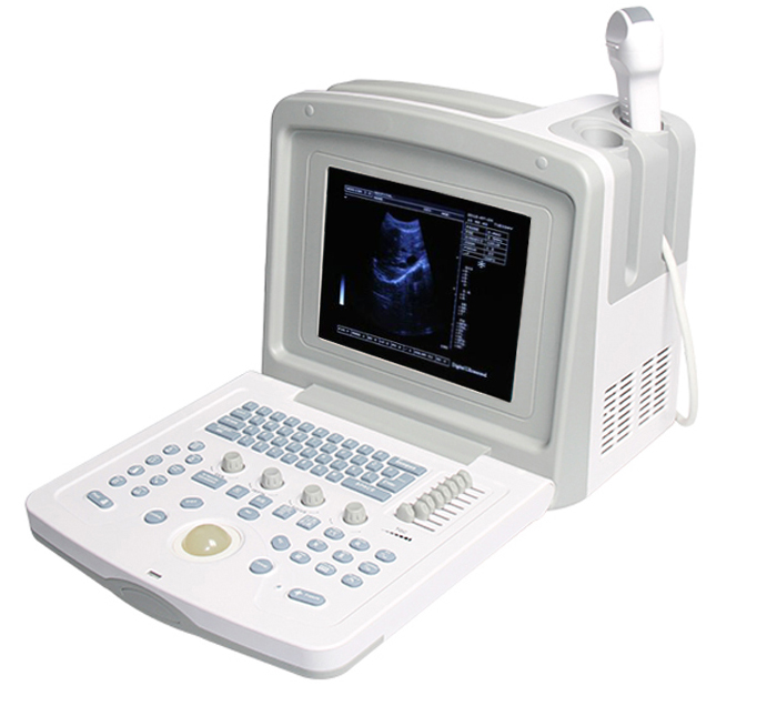 mobile-ultrasound-without-printer-or-cart-image
