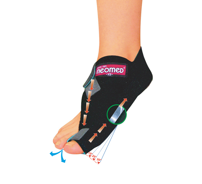 univright-night-toe-corrector-image