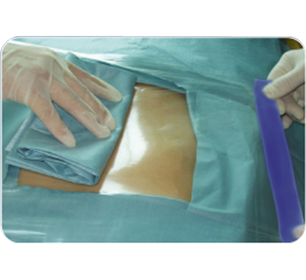 incifilm-adhesive-14cmx10cm-see-other-dimensions-image-2