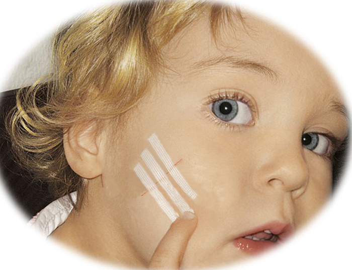 pharmastrips-4mm-x-76mm-see-other-dimensions-image