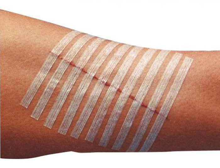 pharmastrips-4mm-x-76mm-see-other-dimensions-image-2