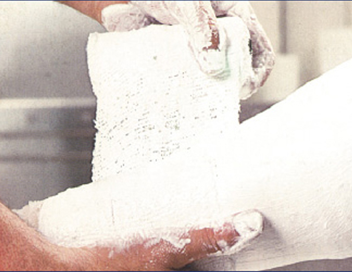 pharma-pop-plaster-band-27m-x-15cm-image